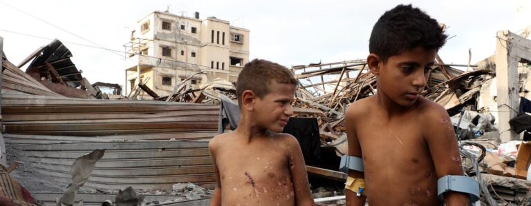 Alarma en Gaza: 6 mil personas han sufrido amputaciones y sistema de salud al borde del colapso