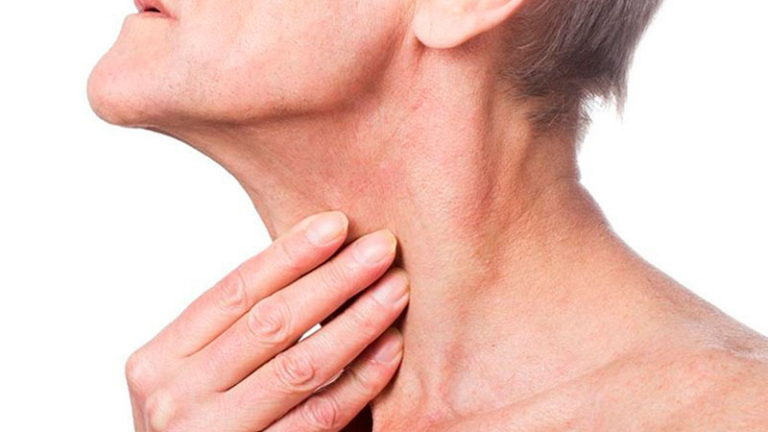 ¿Sabías que hoy es el Día Mundial del Cáncer de Cabeza y Cuello?