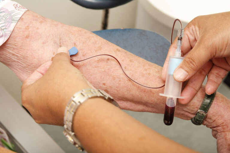 Investigadores de la UTalca avanzan en detección de fragilidad en exámenes de sangre